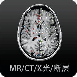 影像解剖图谱免费版 v3.